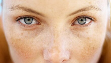 Пігментація на шкірі є результатом складного біологічного процесу, пов'язаного зі зменшенням, збільшенням або порушенням утворення в організмі меланіну