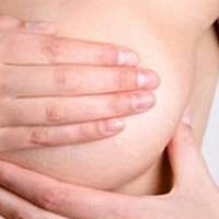 Растяжки на груди хоть и не опасны для здоровья, но малоприятные для любой женщины